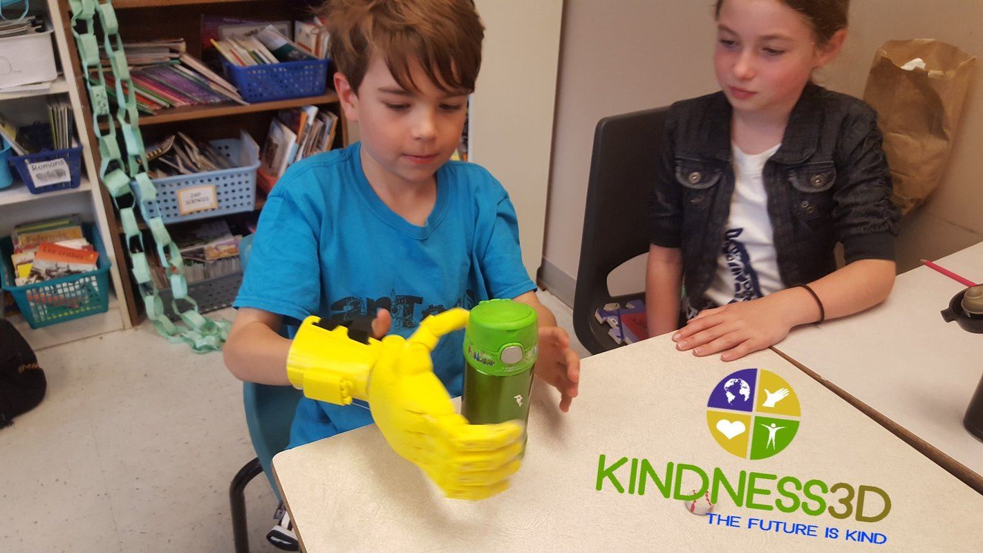 A student tries out a 3D-printed grabber hand at a school in Halifax, Nova Scotia. Kindness 3D takes plastic waste from recreational cannabis containers and turns them into prosthetic limbs.