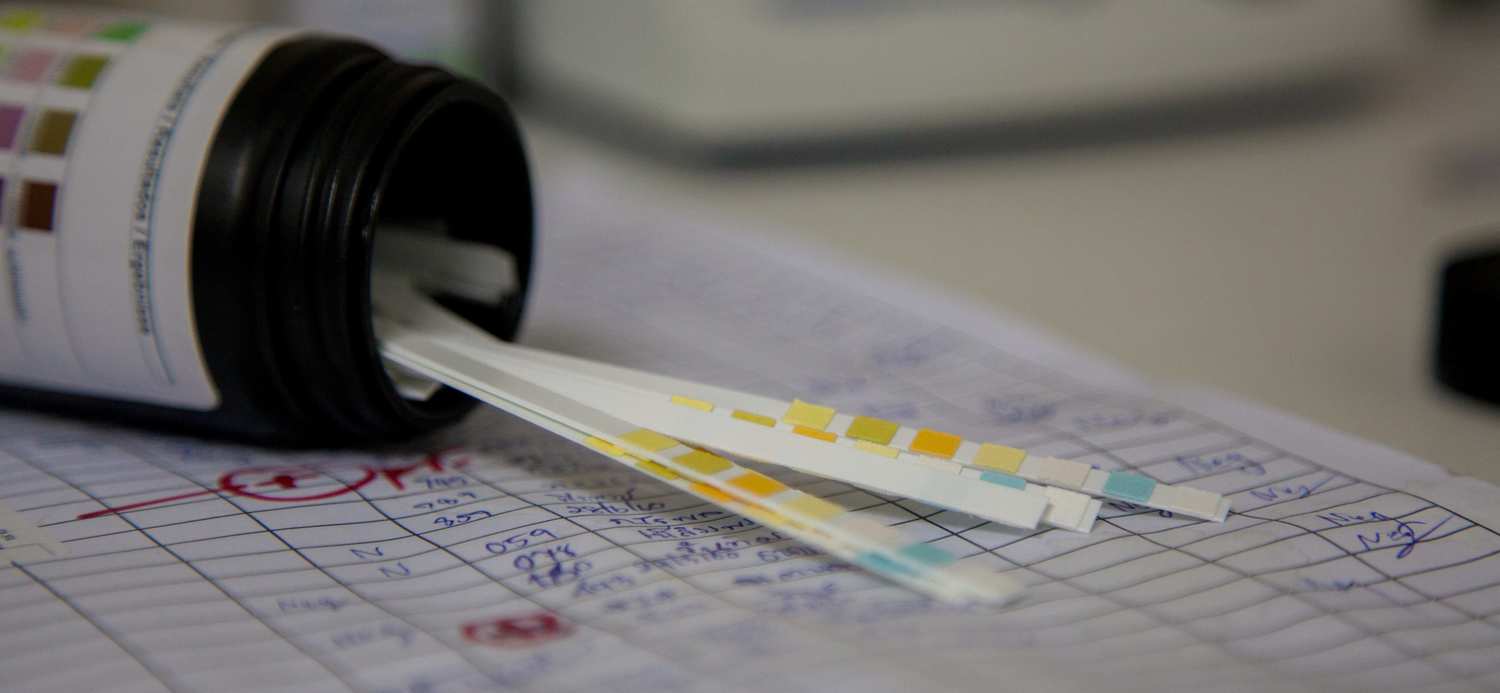 Drug urine test strips spill out onto a page of medical records. Contrary to some beliefs about drug tests and CBD, it is possible but rare for CBD oil to cause someone to fail a drug test.